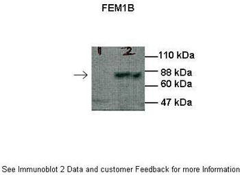 FEM1B Antibody