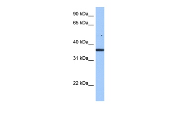 FAM153B Antibody