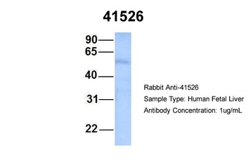 SEPT9(septin 9) Antibody