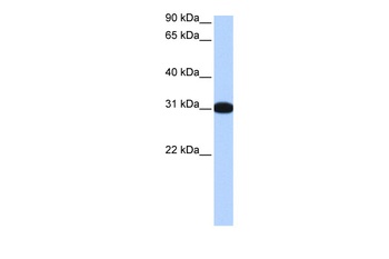 MBNL2 Antibody