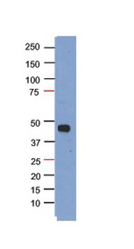 PHF6 Antibody