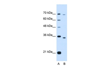 PHF6 Antibody