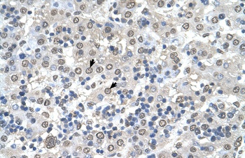 CDR2 Antibody