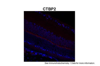 CTBP2 Antibody