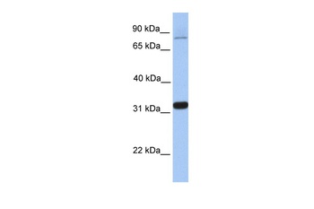 TIPIN Antibody