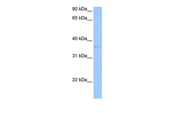 TREML2 Antibody