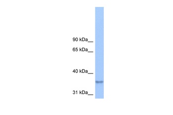 LPPR2 Antibody