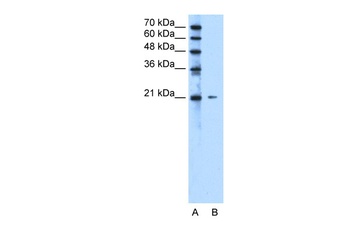 C20orf24 Antibody