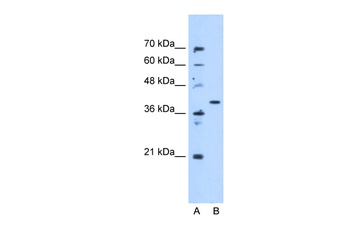 ECHDC3 Antibody