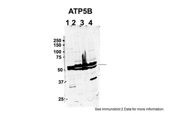 ATP5B Antibody