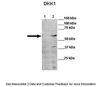 DKK1 Antibody