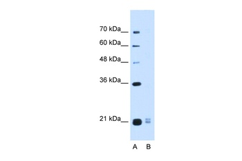 PLAC1L Antibody