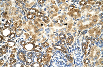 TAMM41 Antibody