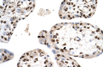 SETD2 Antibody