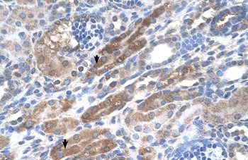KIAA0319 Antibody