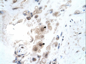KIAA0494 Antibody