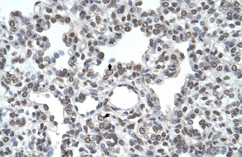 TMPRSS11D Antibody