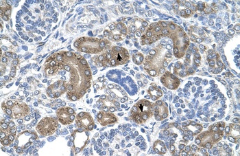 DCTPP1 Antibody