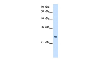 PPCDC Antibody