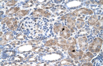 IFI44L Antibody