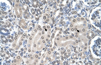 SHMT2 Antibody