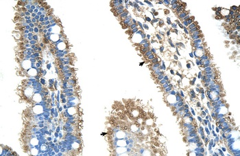 ALDH4A1 Antibody