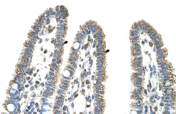 CPS1 Antibody