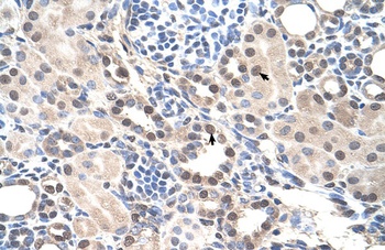 RORA Antibody