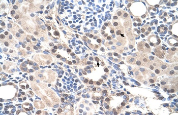 RORA Antibody