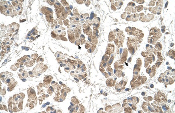 SSR2 Antibody