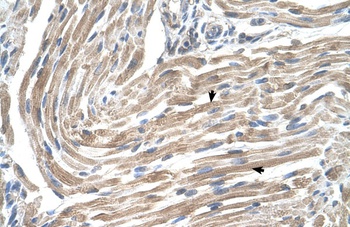 MGST2 Antibody