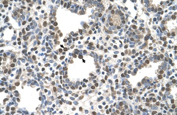 ZDHHC13 Antibody