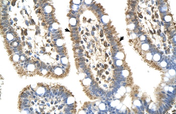 C8B Antibody