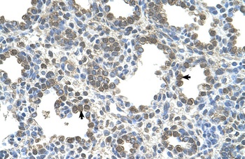 SLC26A5 Antibody