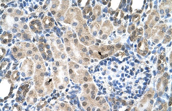 SLC19A1 Antibody