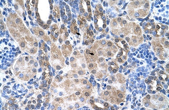 SLC6A18 Antibody