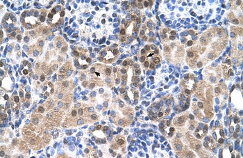 SLC46A3 Antibody