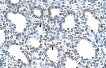 SLC15A4 Antibody