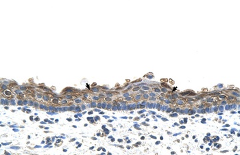 SLC26A1 Antibody