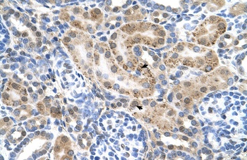 SLC22A3 Antibody