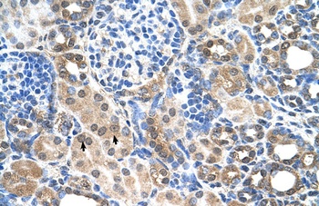 SLC7A14 Antibody