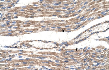 SLC2A6 Antibody