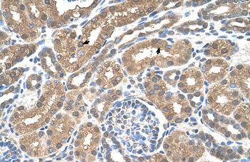 SLC16A8 Antibody
