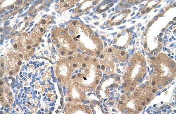 SLC39A6 Antibody