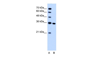 SLC25A29 Antibody