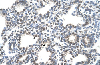 SLC10A5 Antibody
