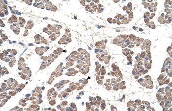 GCDH Antibody