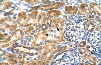 GCNT3 Antibody