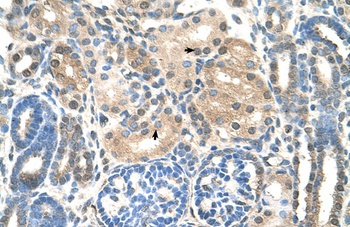 UBE2E2 Antibody