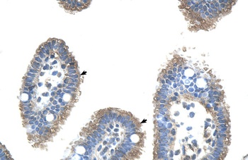UBE2J2 Antibody